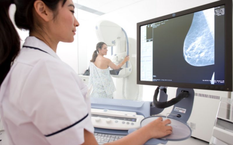 Pesquisa revela que 40% das mulheres não fazem mamografia